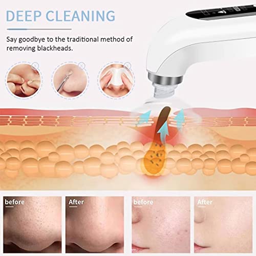 Blackheads Remover Beauty Instrument